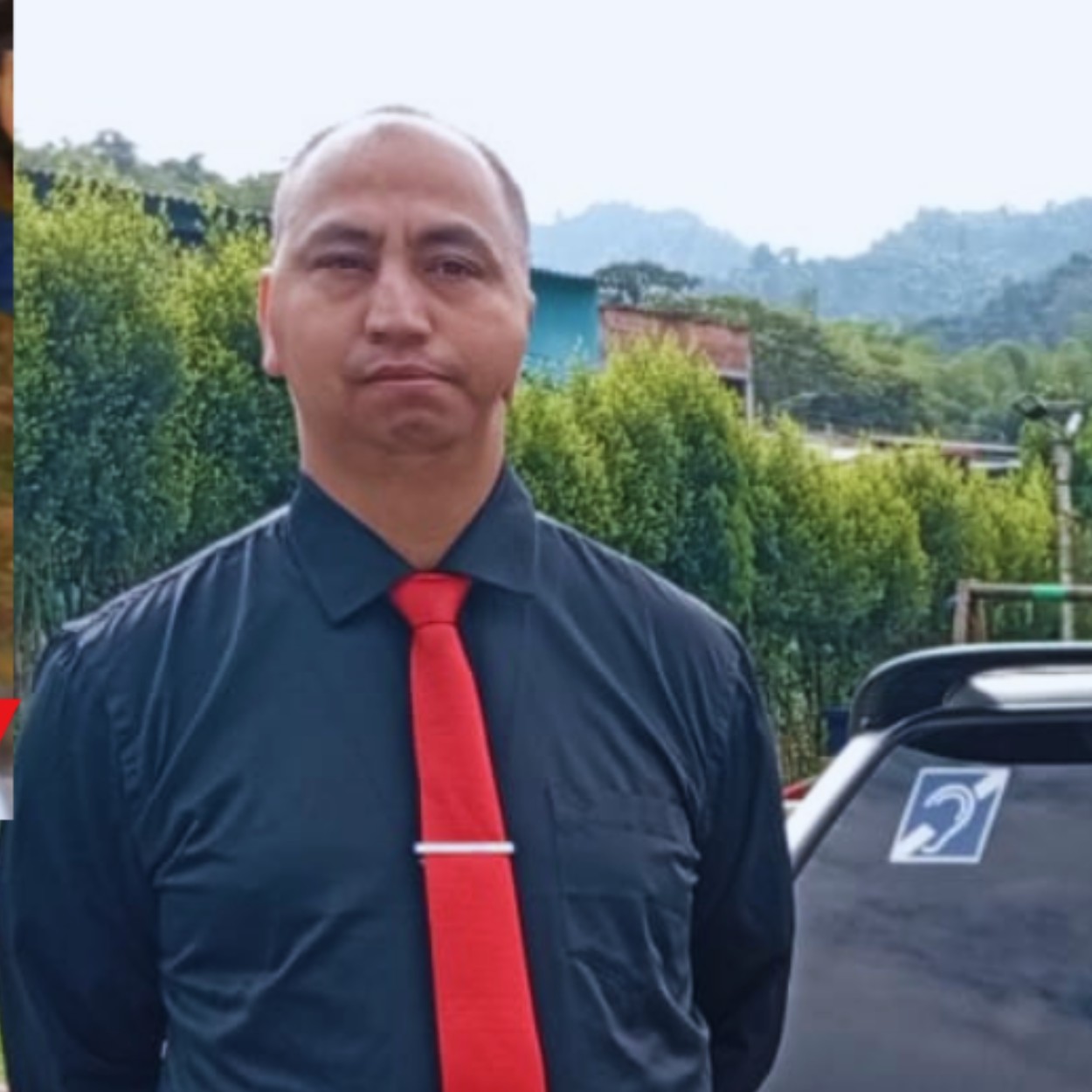 Después 4